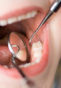 : young girl smiling at dentist office near Wheeling