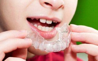 Close-up of little boy putting in a mouthguard