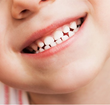 Closeup of child's healthy smile after pulp therapy